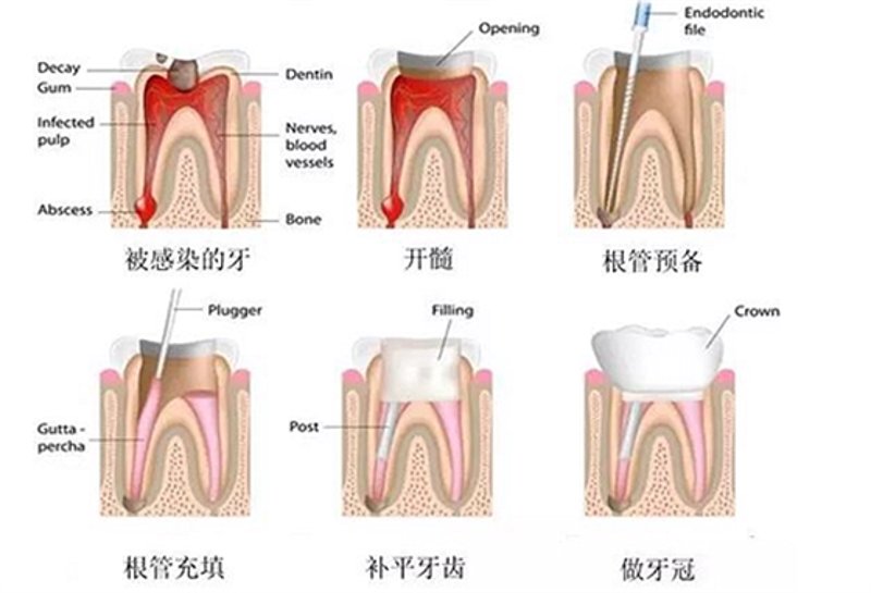 哈尔滨儿童齿科就诊率提升40%:3个数据化解决方案破解家长焦虑