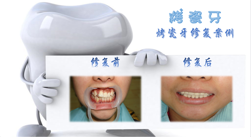 哈尔滨儿童齿科 vs 传统成人齿科：从生理结构到诊疗方式的全面对比
